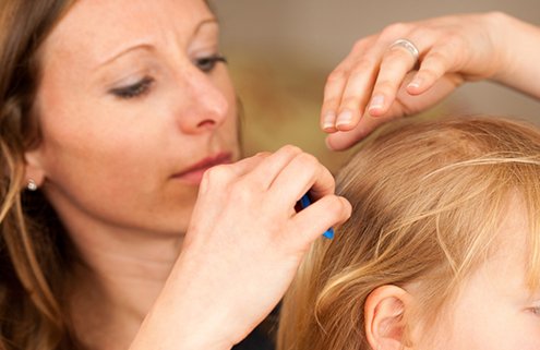 Precisely-how-to-manage-head-lice-at-your-childs-daycare-in-Omaha-NE