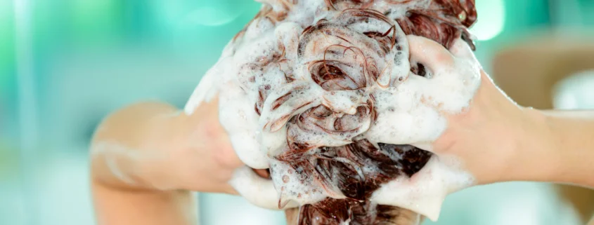 How Long After Lice Treatment Can I Wash My Hair?